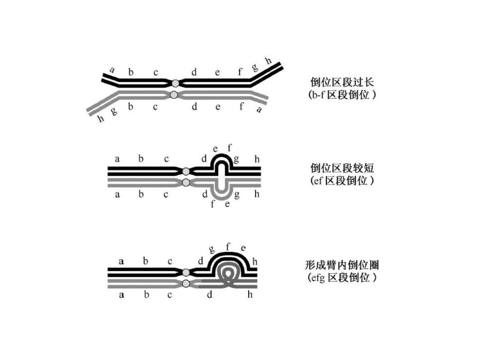 倒位