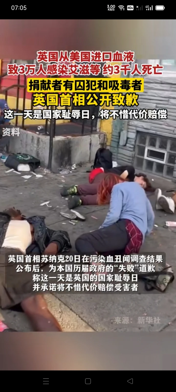 英国血液输入万人感染艾滋病