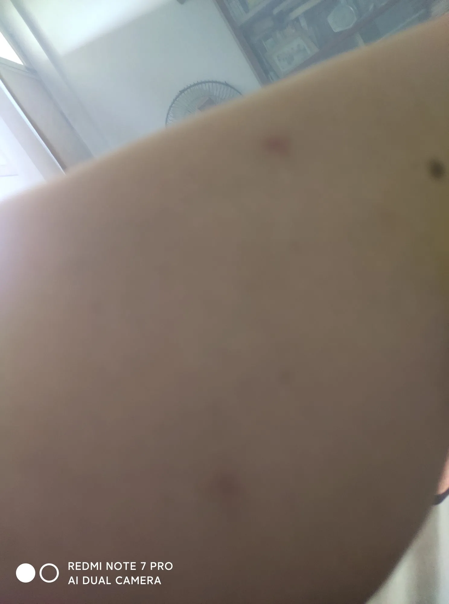 蚊子改大白天出来咬我了，夏天我最怕的的就是蚊虫叮咬，而我家恰恰是蚊虫不断，我那亲
