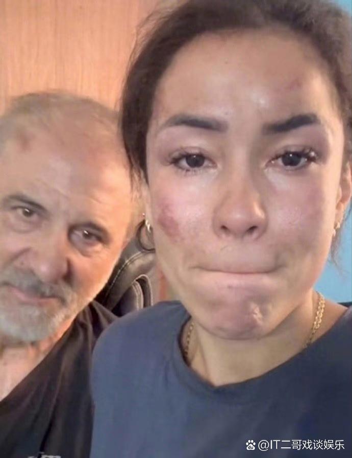 好惨！一名35岁的西班牙女演员在印度骑自行车旅行时遭到7人抢劫施暴，其丈夫也惨遭