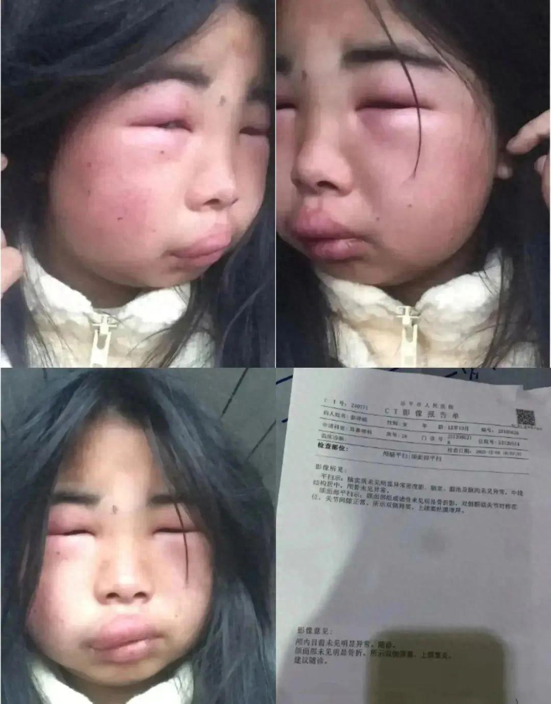 真因为刑不上小孩才导致霸凌频繁