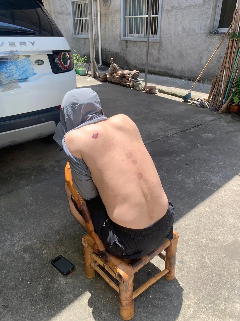 三伏天晒背打卡 
