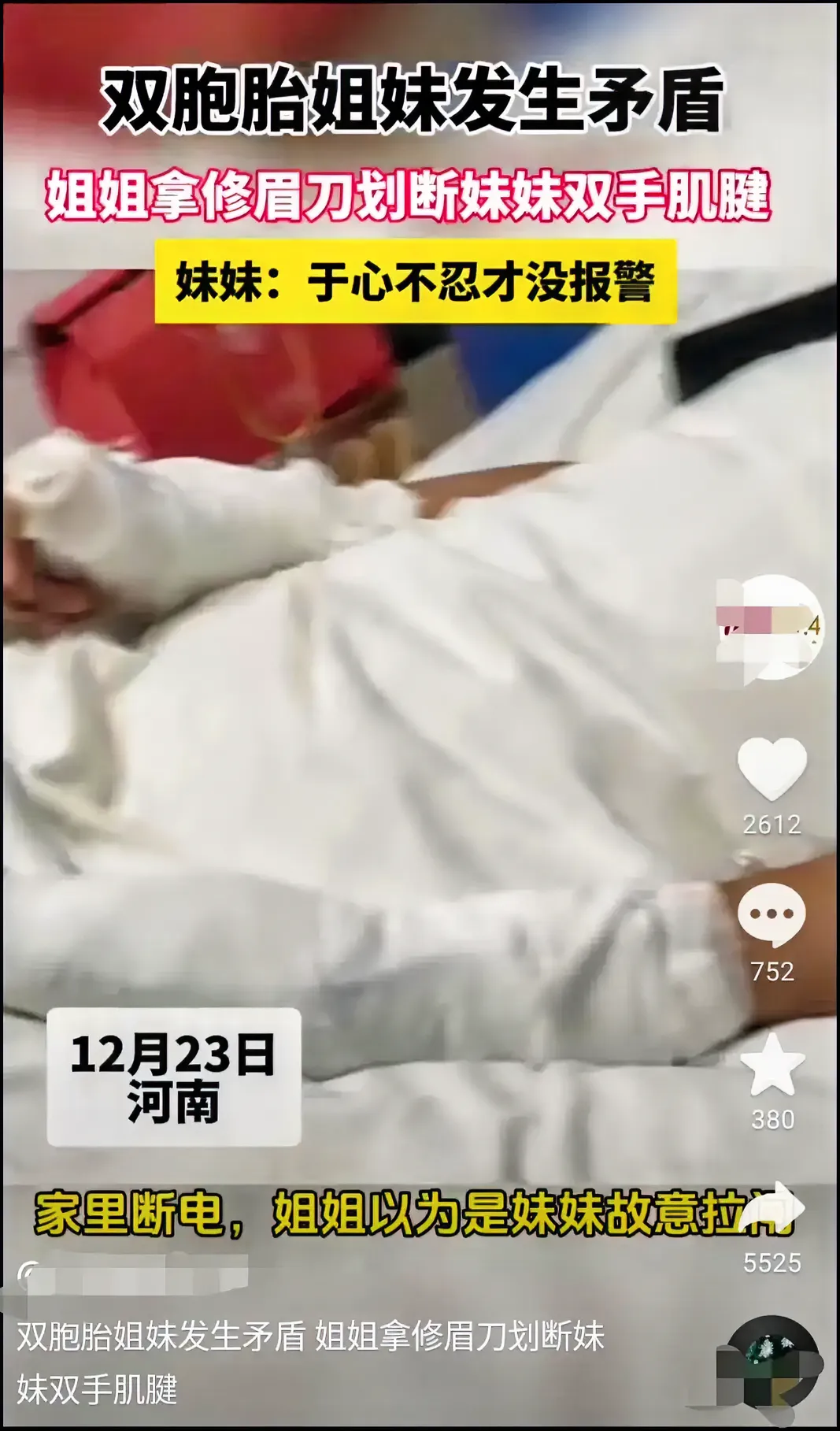 现在的小孩实在不敢想象，亲姐姐割断亲妹妹的双手肌腱，是有僧仇大恨？还是龇牙必报，
