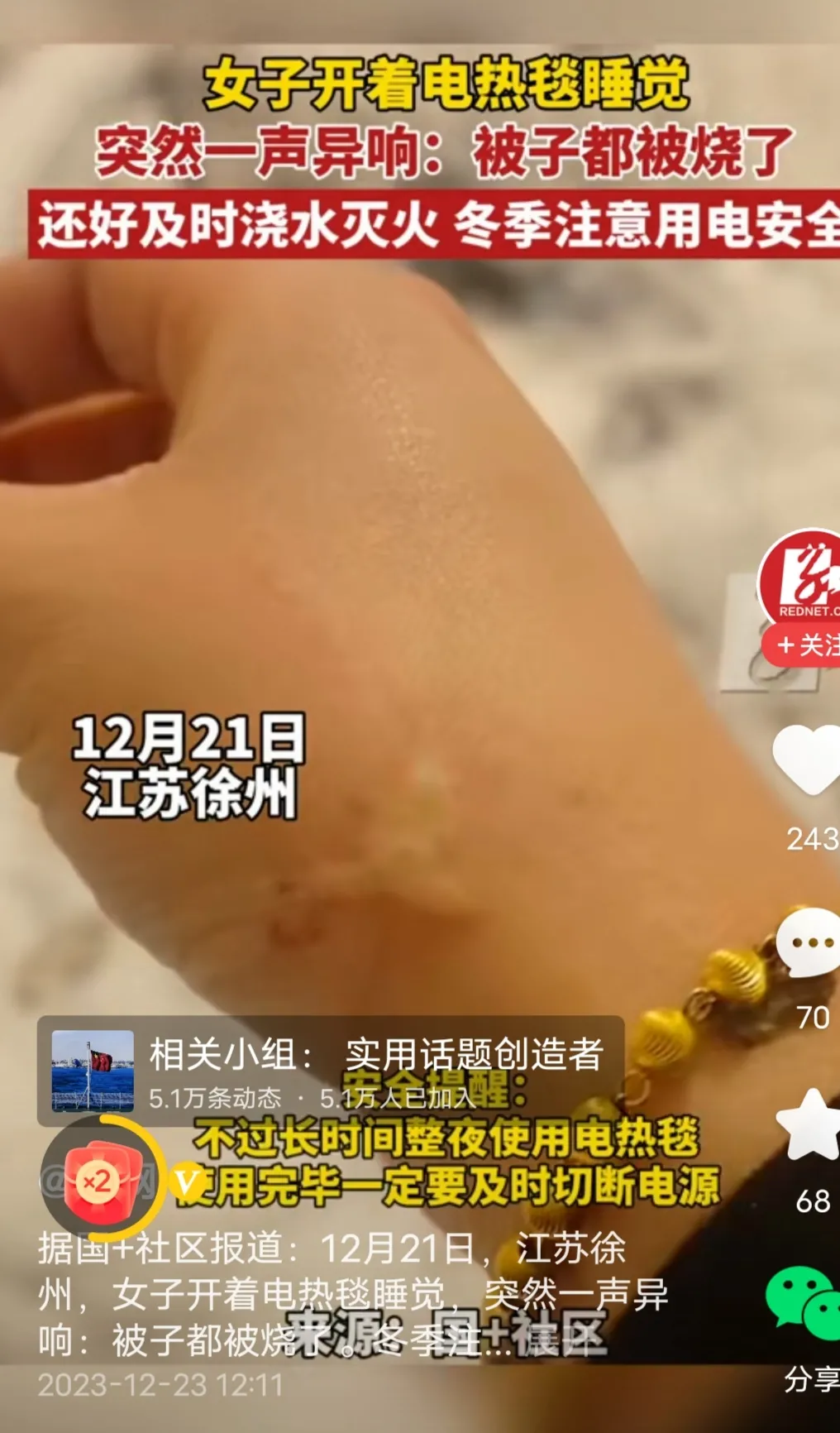 看到一个这样的新闻，江苏徐州一女子睡觉的时候，半夜突然一阵异响，被子被烧着了这几