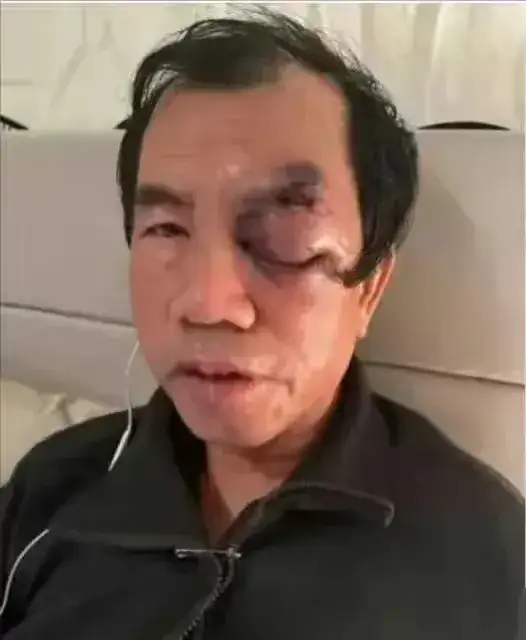 润人梁新民在美国被白人狠揍，然后觉得是自己惹主子白人生气了，决定撤销报警，并对白