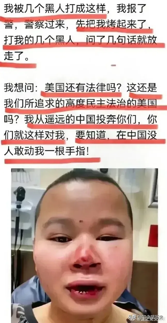 为什么国内大量的公知不敢去美国，只敢在国内犬吠？
1、因为他们深知自己的水分很高，在美国人的眼里连狗都不如，去了美国毫无价值，只能当废物，连自己都养不活，只能吃救济，刷盘子，睡公园，被强奸，挨黑人揍。