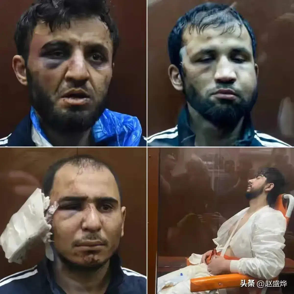 对付暴恐分子还得看俄罗斯人的手段，你看看被抓的四个恐怖分子，
一个脸被打得肿半边