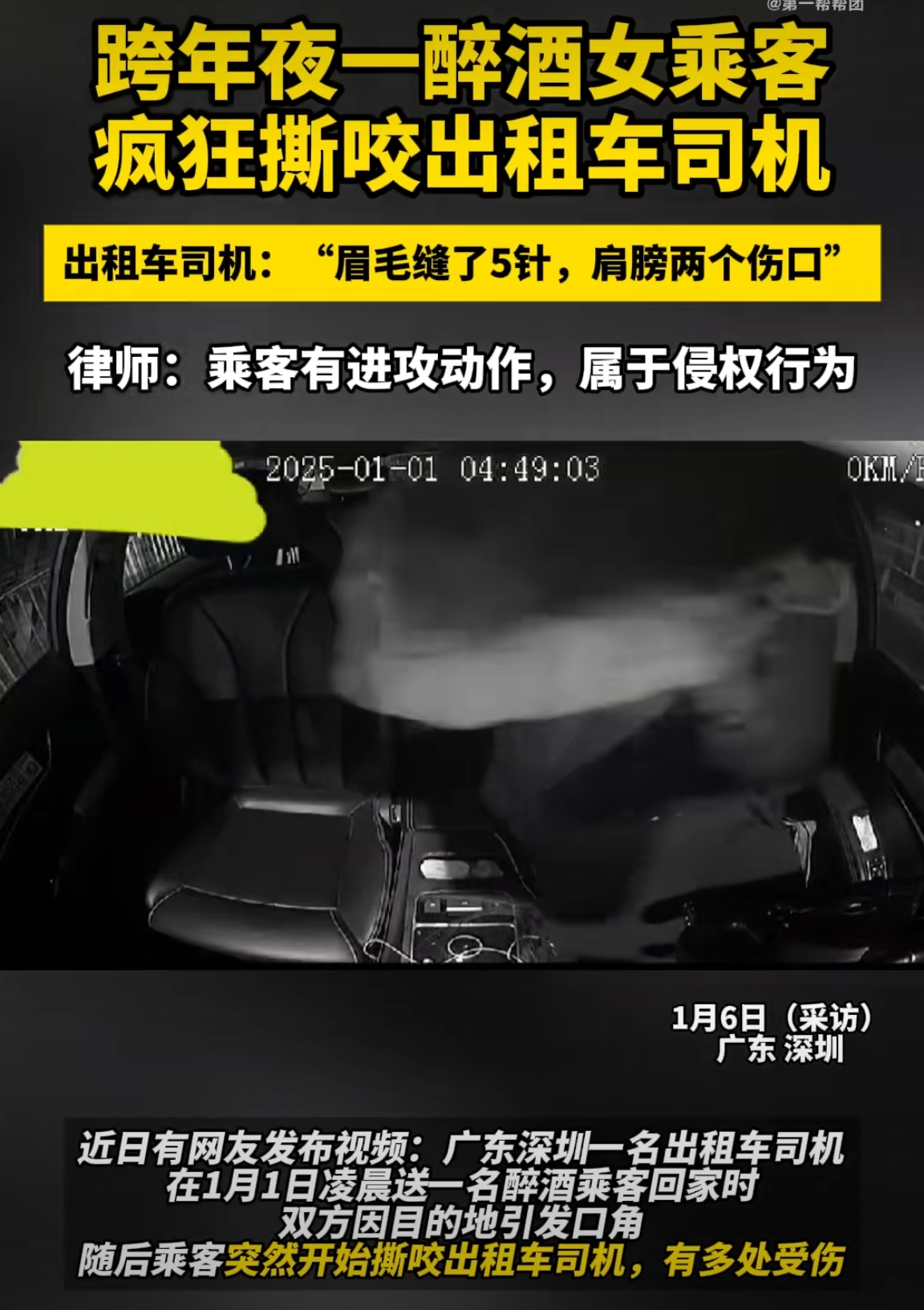 替这个司机捏三把汗呀：
第一，没被反咬一口性侵。
第二，没被网络舆论攻击。
第三，目前还没得狂犬病。
#醉酒女乘客疯狂撕咬出租车司机#【醉酒女乘客 疯狂撕咬出租车司机 出租车司机：“眉毛缝了5针，肩膀