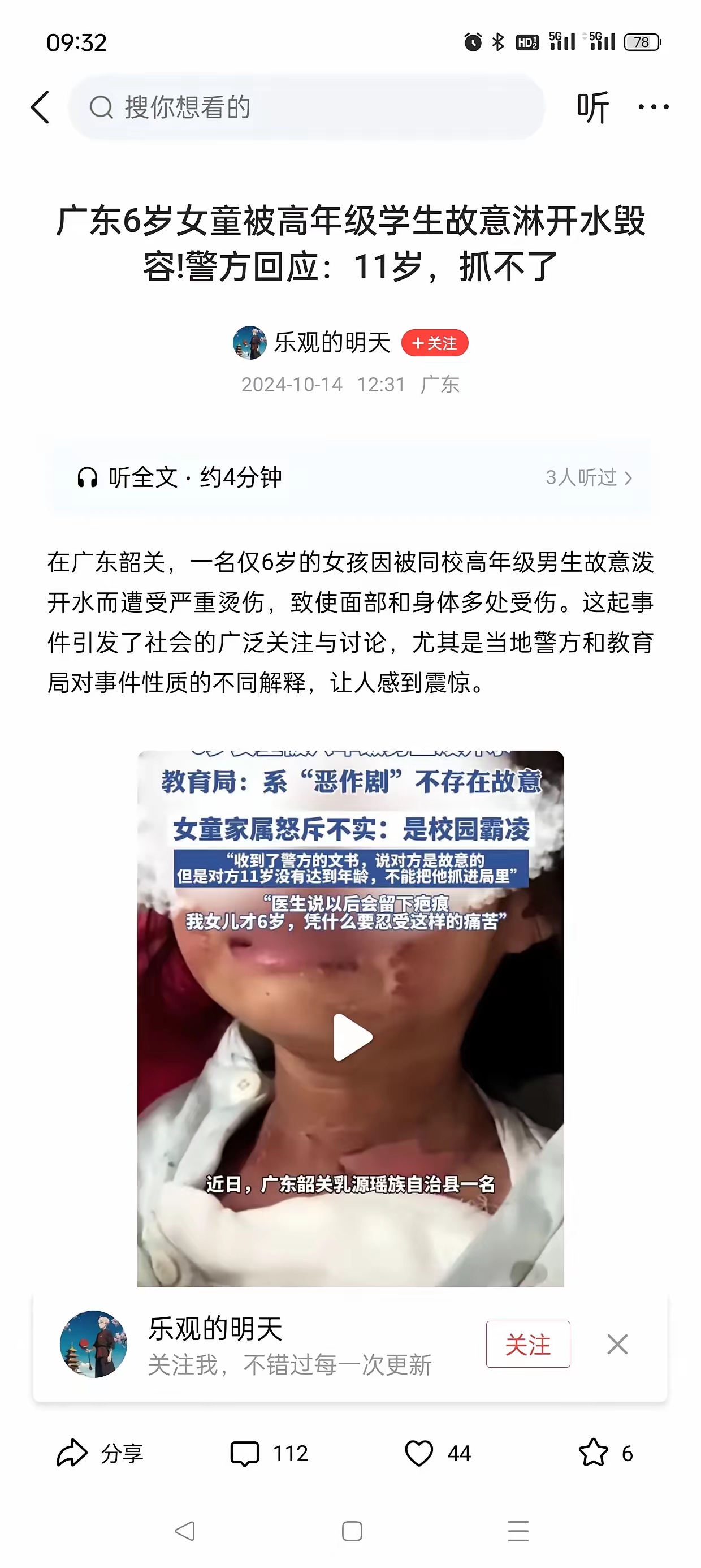 11岁的孩子，伤人，还真抓不了，只能监护人和学校赔偿。