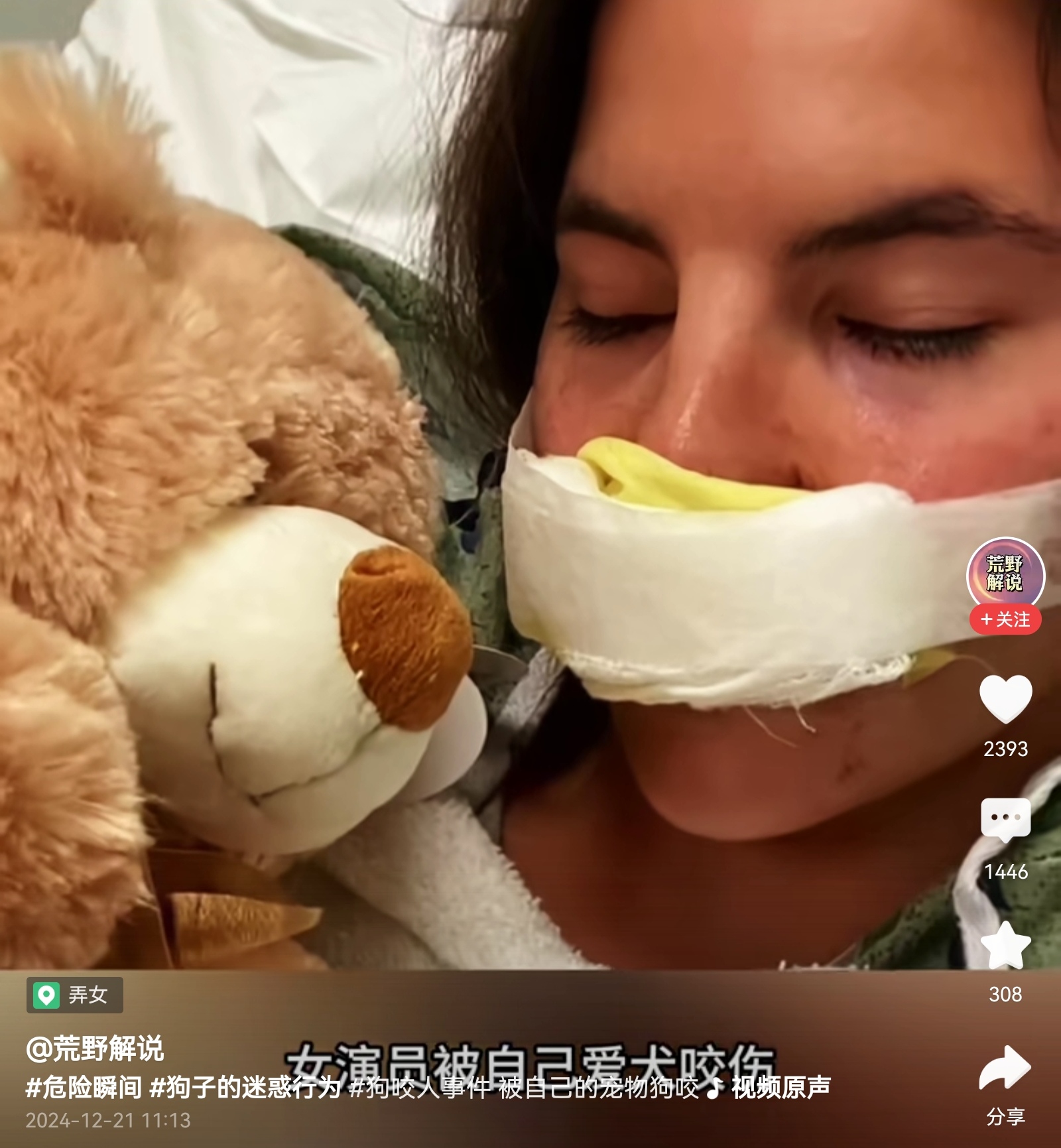 狗咬主人这是家庭内部矛盾，外人不适合参与，旁观就可以了，这或许也是爱的代价！