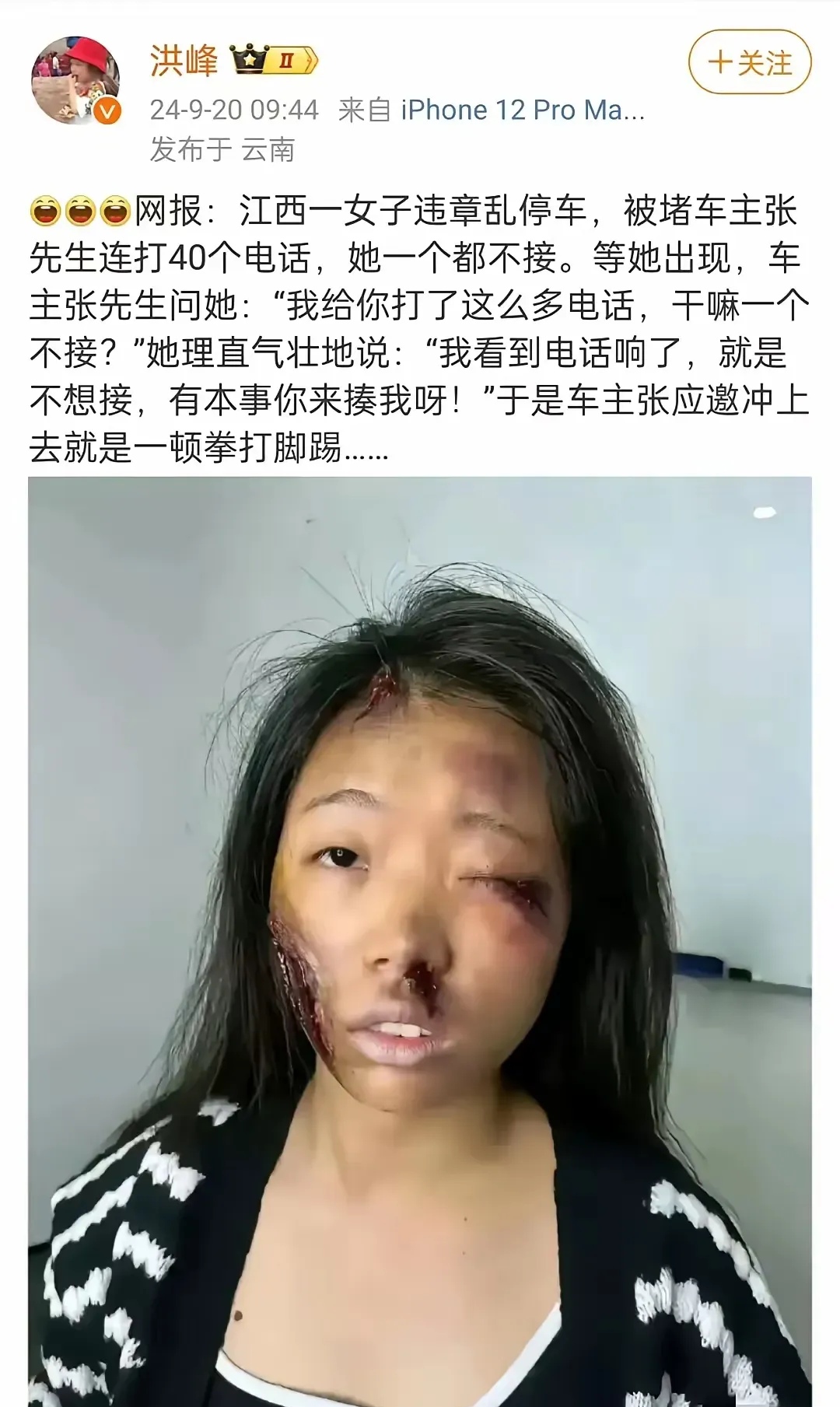 有点假，被打成这样，不去派出所，而上网，有点不像话。另外，如果真有这样的新闻，早就发酵了。