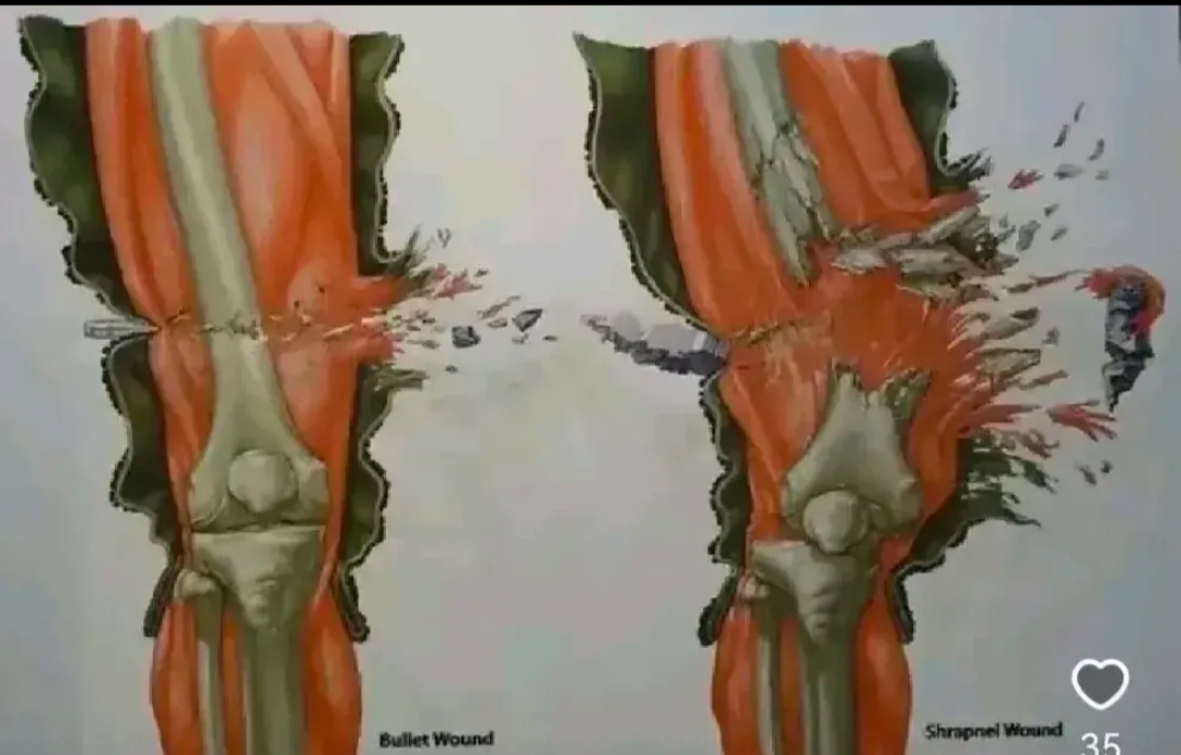 电影里太弱化子弹的威力了，子弹把大腿骨打断很轻松。厚实的肌肉组织包裹，但在高速弹丸和破片面前也一样不堪一击。

真以为中了子弹后，还能硬扛疼痛健步如飞是吧，现实中你只会直勾勾的倒下去。

军用步枪的弹