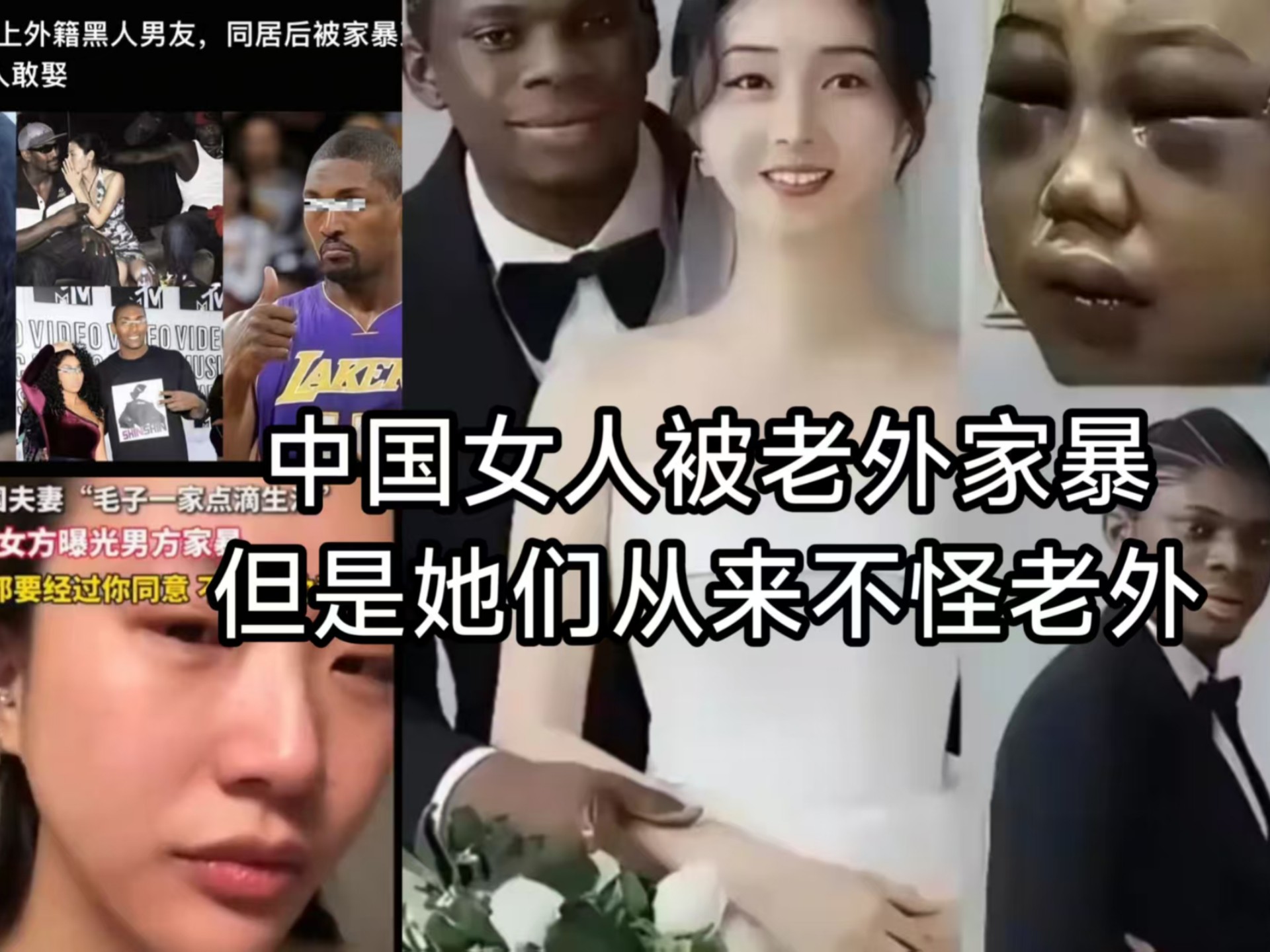 看看新闻吧！多少姑娘被非洲老公家暴打成重伤，医院躺着都不敢报警，娘家隔着半个地球根本没法捞人。

可偏偏这些姑娘当初个个信誓旦旦：“人家非洲人不讲究彩礼，多淳朴！”放着国内月薪上万、有房有车的男生不要