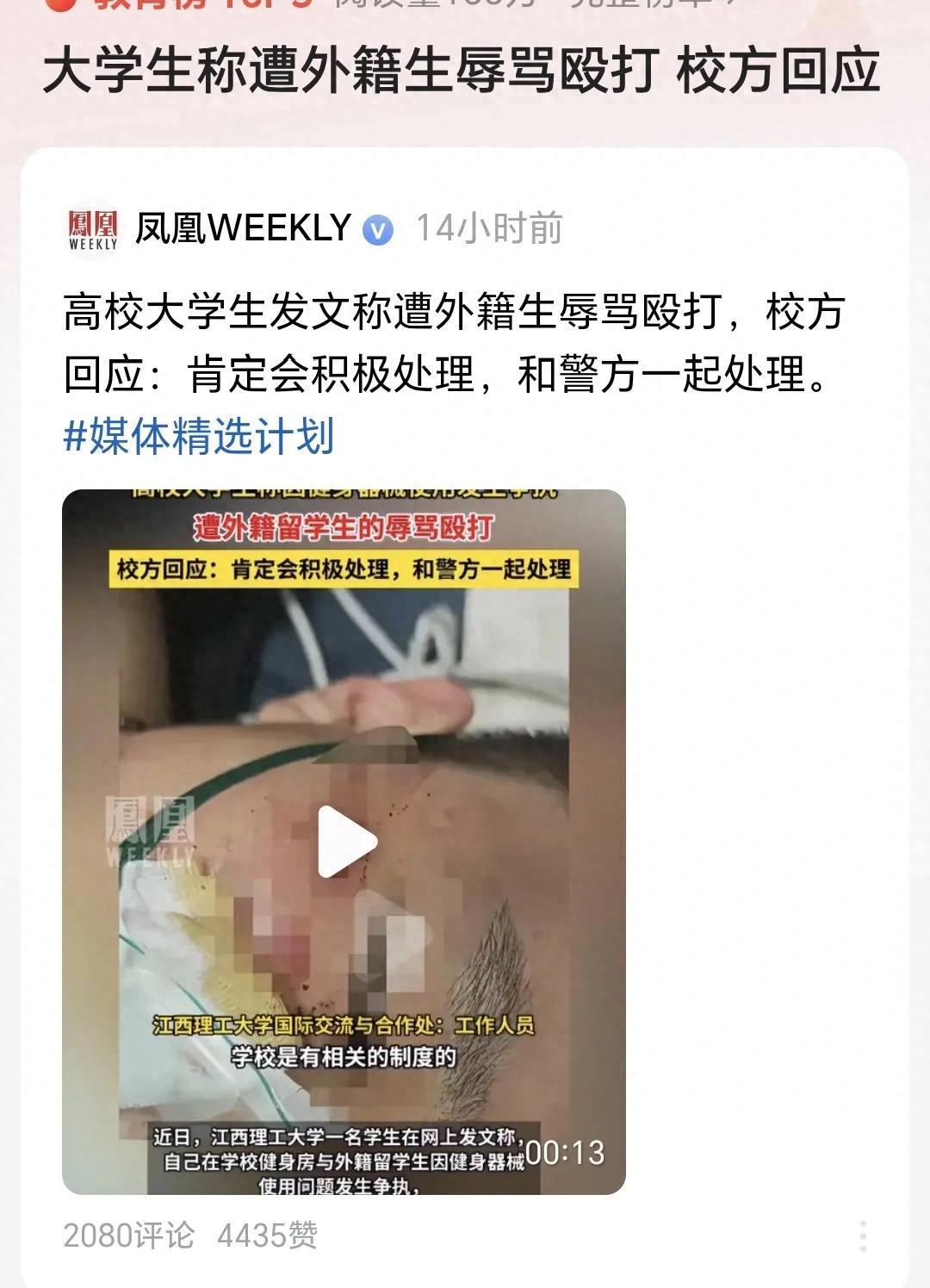 巴基斯坦咋也没想到，自家留学生突然成了舆论焦点！眼下印巴冲突正胶着，巴方盼着中方支持呢，江西理工大学一个巴基斯坦留学生却因为点事儿上了热搜。

不过中国网友的反应挺暖心——有人翻出巴铁留学生疫情时当志