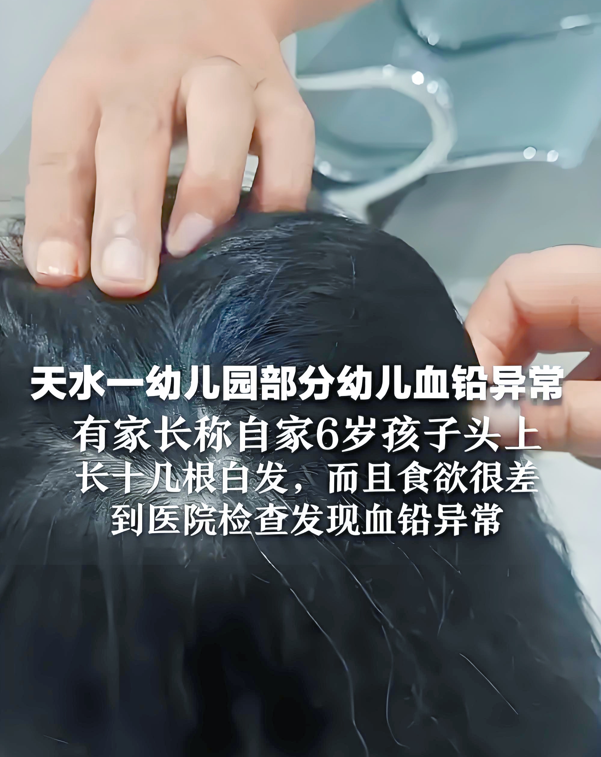 近日，甘肃天水麦积区褐石培心幼儿园违规使用添加剂致幼儿血铅异常事件，引起了社会各界的广泛关注和担忧。多名幼儿出现血铅超标的情况，其中一名幼儿血铅值高达528微克/升，超标4倍多 ，这一事件不仅刺痛了家