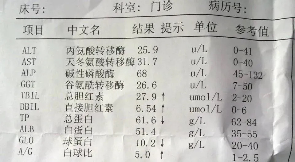 1分钟教你看懂肝功能检查单常见的5种“酶”

1. 谷丙转氨酶ALT
正常值0~40U/L，指标偏低一般没有临床意义。轻度升高多见于熬夜、饮酒、过度劳累等生理性因素。大于2倍、超过80U/L，多见于各