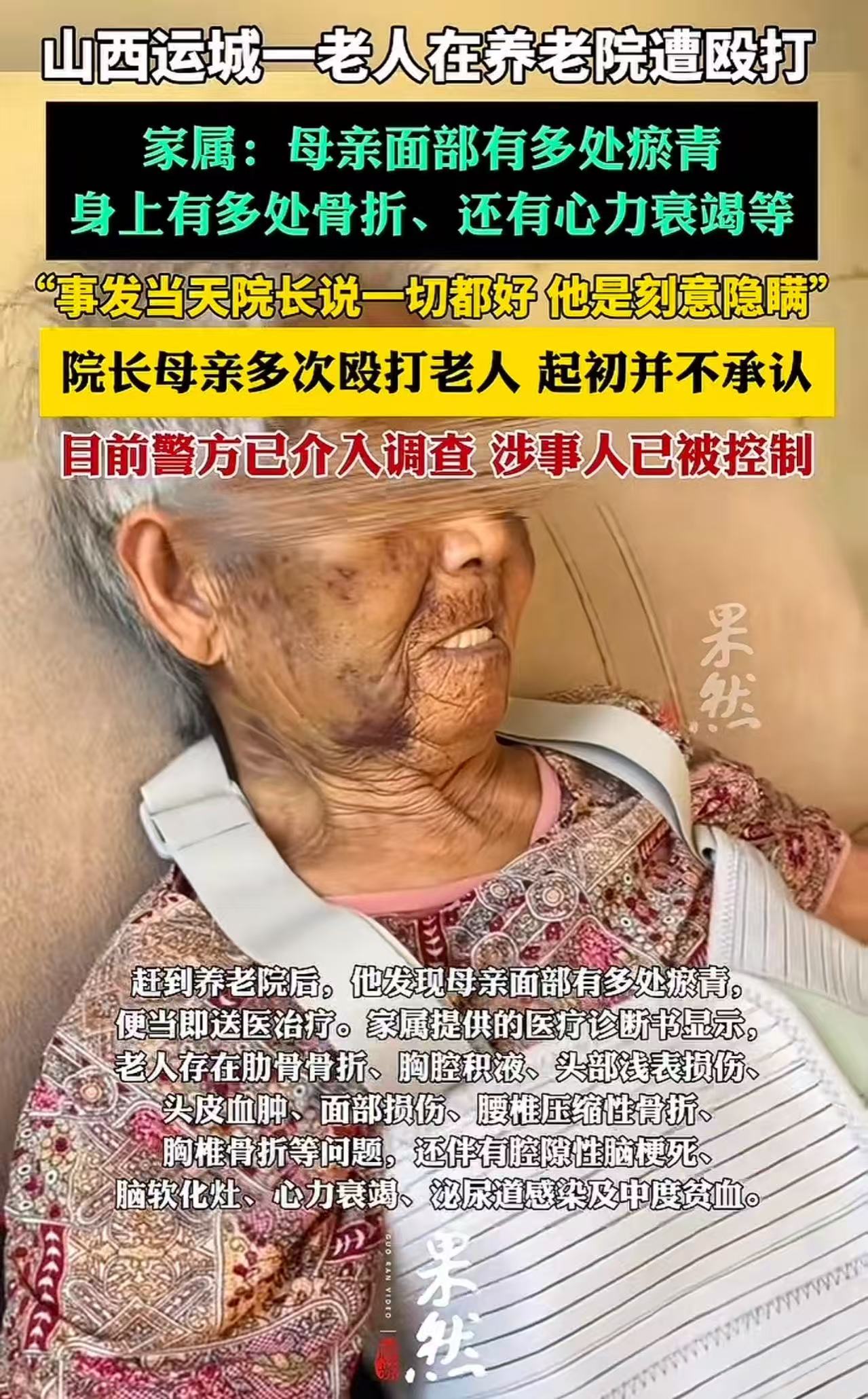 山西运城，八旬老人偷偷给儿子打电话，说自己被养老院院长的母亲从凌晨3点殴打到天亮，还威胁不能说出去！儿子很震惊，立马赶去养老院，看到母亲被打得鼻青脸肿，身上多处骨折和淤青！儿子：“院长还骗我说一切都好