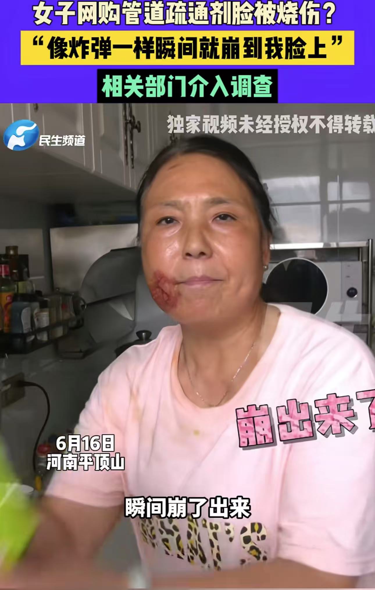 太吓人了！河南平顶山，女子家里的下水道堵住了，喊人疏通太贵，就自己在网上买了一包疏通剂，可是女子把疏通剂和温水倒入管道后，突然“砰”的一声，管道里的液体涌出喷到了女子脸上，女子疼的顿时大叫！

（来源